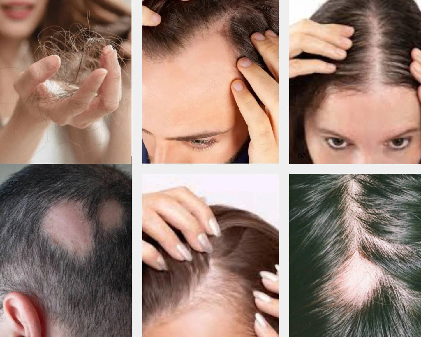 Spray Para Crecer El Pelo Ouhoe (COMPRE UNO Y LLÉVESE OTRO GRATIS) +50% de descuento